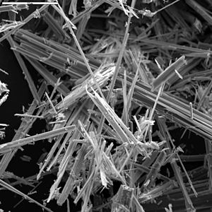 Exposure to asbestos fibers can cause malignant Mesothelioma